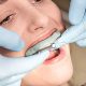 South Muskoka Dental Group bruxism